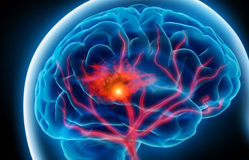 neurology specialist